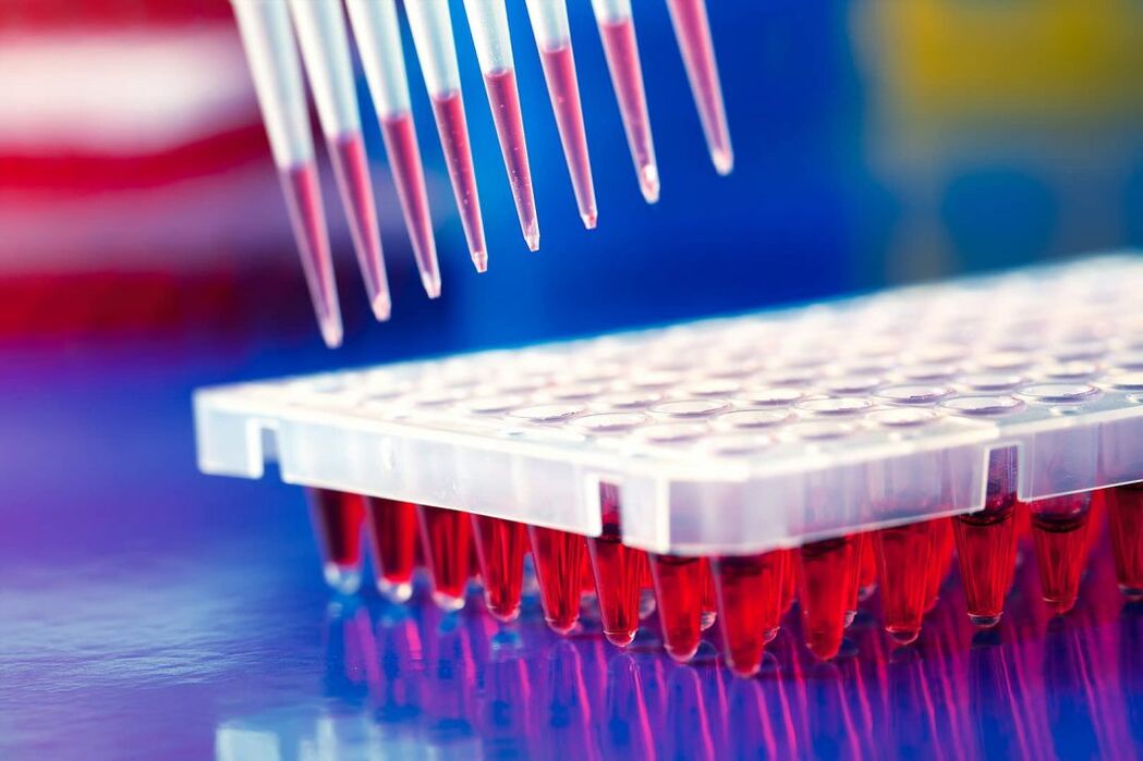 imunologinis kraujo tyrimas parazitams nustatyti